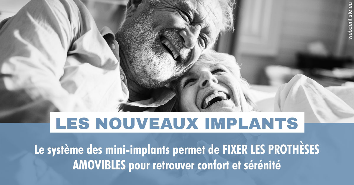 https://www.cabinetcipriani.fr/Les nouveaux implants 2