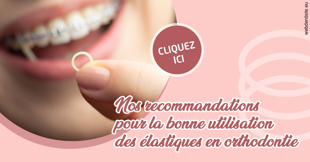 https://www.cabinetcipriani.fr/Elastiques orthodontie 1