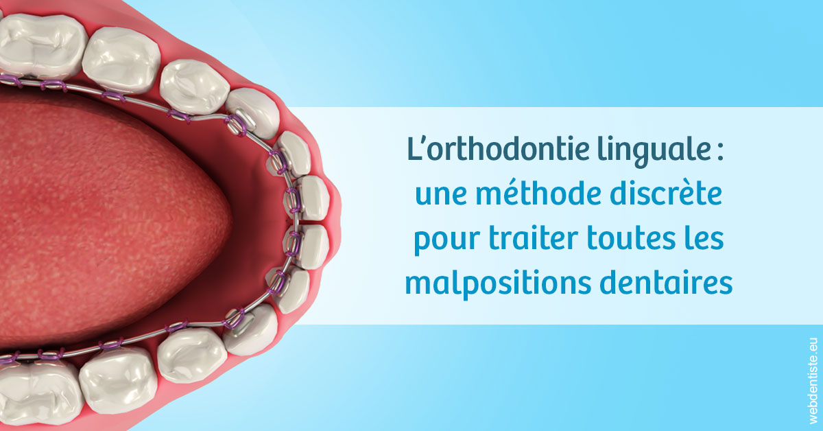 https://www.cabinetcipriani.fr/L'orthodontie linguale 1