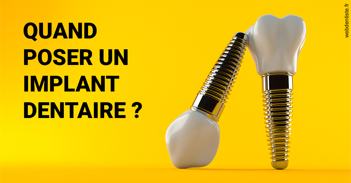 https://www.cabinetcipriani.fr/Les implants 2