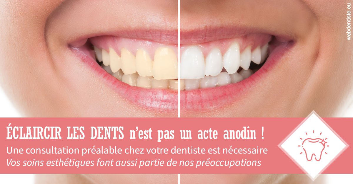 https://www.cabinetcipriani.fr/Eclaircir les dents 1
