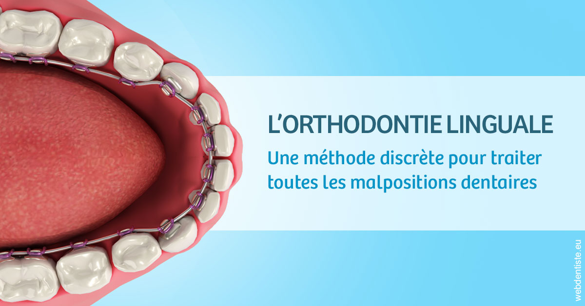 https://www.cabinetcipriani.fr/L'orthodontie linguale 1