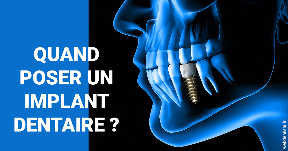 https://www.cabinetcipriani.fr/Les implants 1