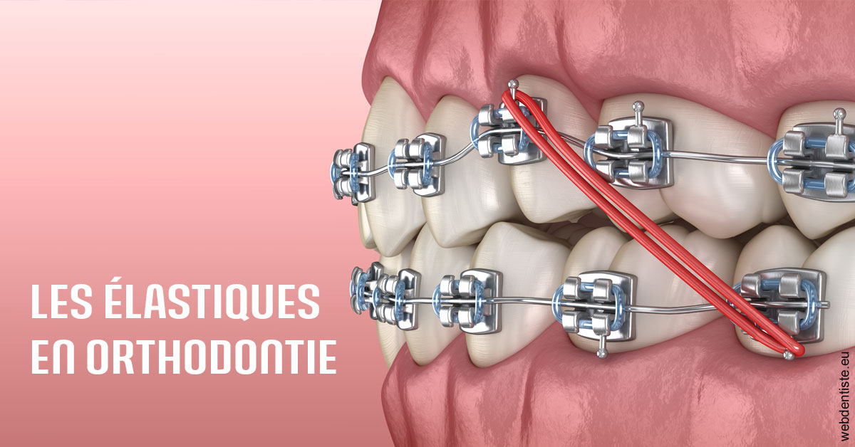 https://www.cabinetcipriani.fr/Elastiques orthodontie 2
