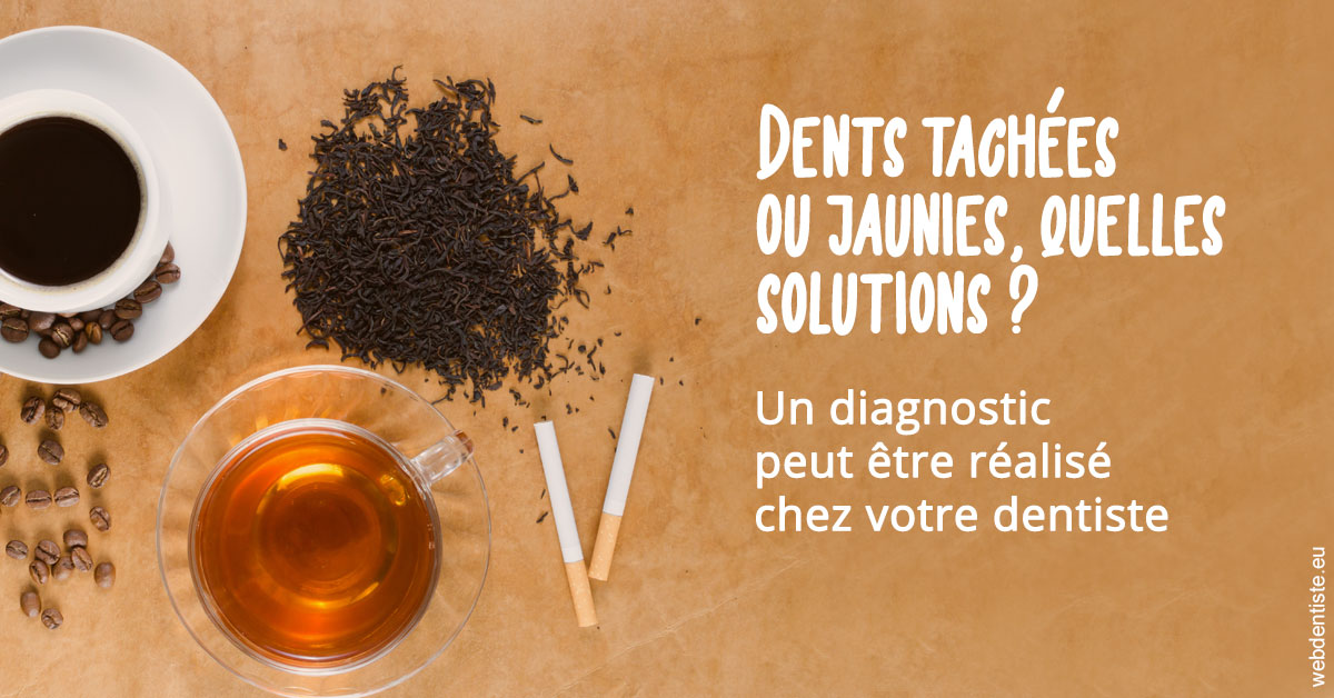 https://www.cabinetcipriani.fr/Dents tachées 2